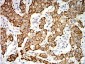 Mouse Monoclonal Antibody to KRT19