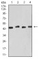 Mouse Monoclonal Antibody to KRT19