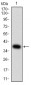 Mouse Monoclonal Antibody to MITF