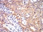 Mouse Monoclonal Antibody to KRT10