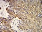 Mouse Monoclonal Antibody to KRT10