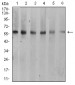 Mouse Monoclonal Antibody to KRT10