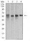 Mouse Monoclonal Antibody to KRT10