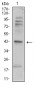 Mouse Monoclonal Antibody to ADRB2