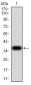 Mouse Monoclonal Antibody to THBS1