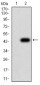 Mouse Monoclonal Antibody to NEFM