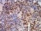 Mouse Monoclonal Antibody to CIRBP