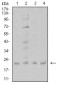 Mouse Monoclonal Antibody to CIRBP