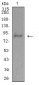 Mouse Monoclonal Antibody to ADAMTS1