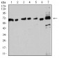 Mouse Monoclonal Antibody to ESR1