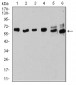 Mouse Monoclonal Antibody to ESR1