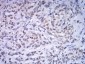 Mouse Monoclonal Antibody to ATF4