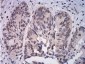 Mouse Monoclonal Antibody to ATF4