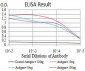 Mouse Monoclonal Antibody to ATG2A