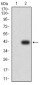 Mouse Monoclonal Antibody to ATG2A