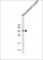 FGF2 Antibody (Center)