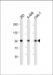Nephrin (Y1210) antibody
