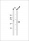 Bik BH3 Domain Antibody