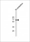 CNOT4 Antibody