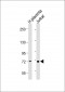 TAP2 Antibody (N-Term)
