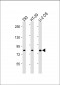 ADD1 Antibody (Center)