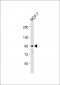 TGFBR3 Antibody (N-Term)