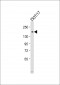 POLA1 Antibody (N-Term)