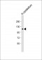 GRM2 Antibody (C-Term)