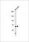 IL1RAP Antibody (C-Term)