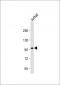 PI3KR1 Antibody (N-term L11)