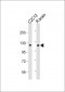 HK1 (Hexokinase) Antibody (N-term)