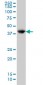 GLUL monoclonal antibody (M01A), clone 2B12