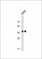 YOD1 Antibody (C-term)