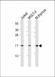 CD3Z Antibody (C-term)
