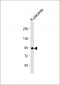 F13A1 Antibody (N-Term)