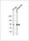 F13A1 Antibody (N-Term)