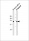 GCA Antibody (N-Term)
