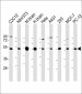 beta II Tubulin Antibody