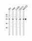 Vimentin Antibody (S82)