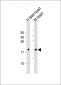 NPPA Antibody (N-term)