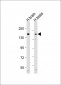 ABCC3 Antibody (Center)