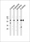 CRTR1 Antibody (N-term)