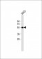 CRTR1 Antibody (N-term)