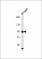 Mouse TLR2 Antibody (C-term)