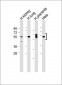 SGK (Ser78) Antibody