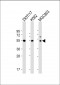 Cyclin A (CCNA2) Antibody (N-term)