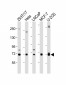 GC Antibody      (Center)