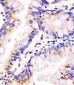 PLA2G7 Antibody (Center)