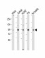 NUP93 Antibody (N-Term)