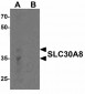 SLC30A8 Antibody